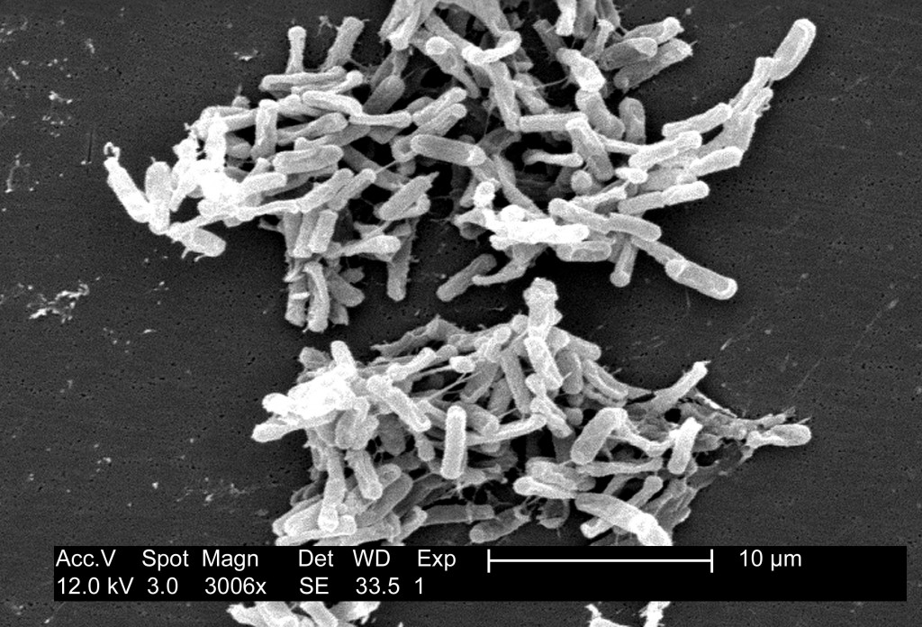 A micrograph of bacterium Clostridium difficile. Credit: Wikimedia Commons.